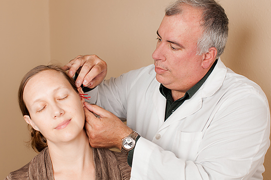 auricular acupuncture