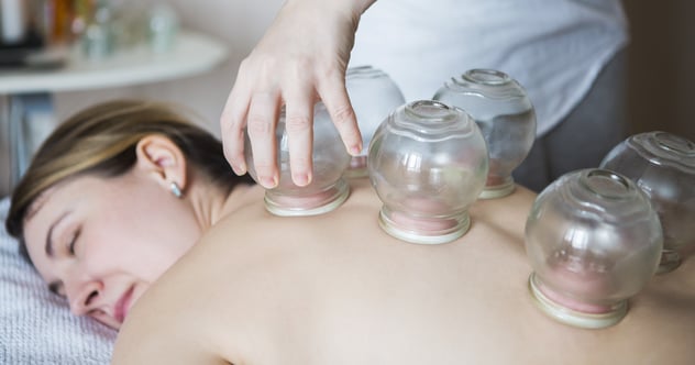 cupping therapy Austin