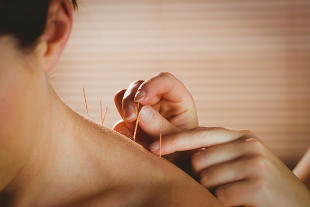 Austin acupuncture clinics Austin acupuncture clinics