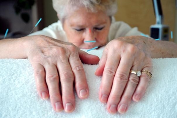 Traditional Chinese Medicine Treatment Of Arthritis traditional-chinese-medicine-treatment-of-arthritis