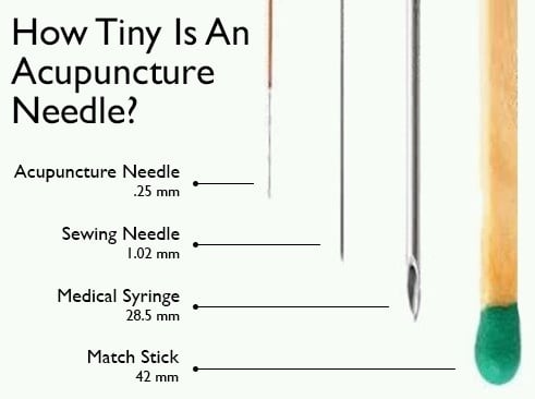 Acupuncture Needle Gauge Chart